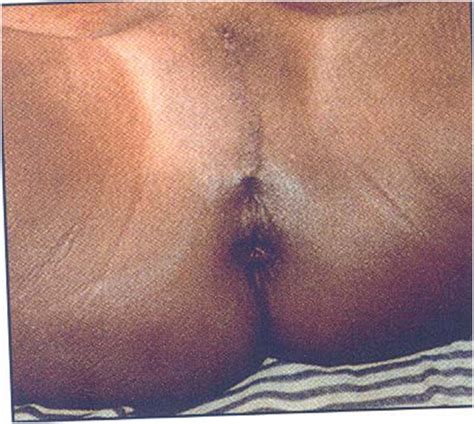 clitorectomies in egypt mega porn pics