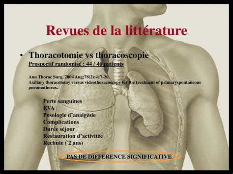 Ppt Traitement Chirurgical Du Pneumothorax Spontané Powerpoint