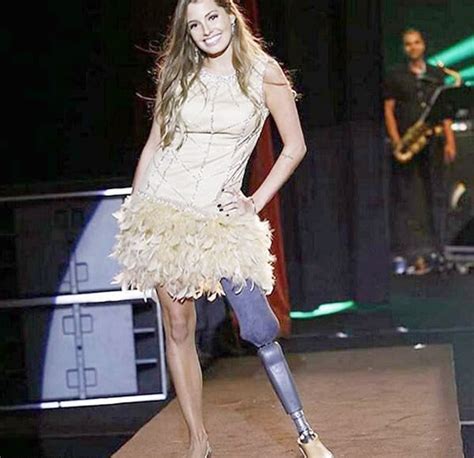 21 Year Old Model Proudly Shows Her Prosthetic Limb In