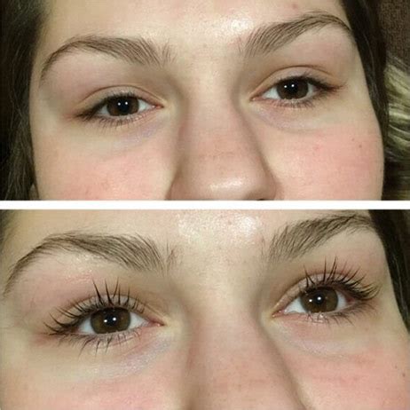 waxing edmonton electrolysis eyebrow bikini brazilian
