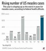 Measles sketch template