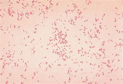 Gram Negative Coccobacilli Bacteria Gram Negative