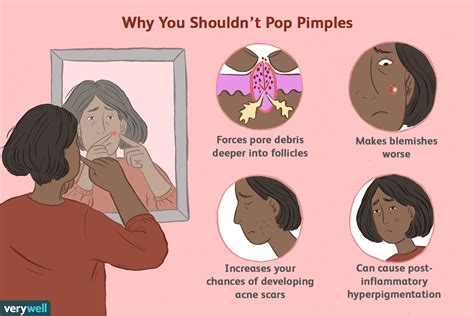 is popping pimples bad for your skin