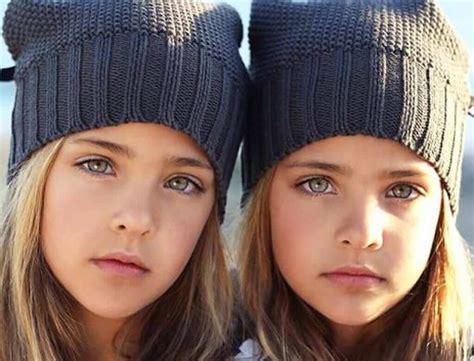 ‘most beautiful twins in the world become instagram stars