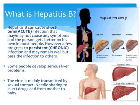 Hepatitis B Types Symptoms Causes Diagnosis Prevention Hot Sex Picture