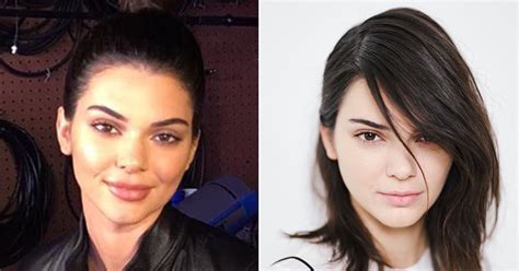 Has Kendall Copied Kylie Jenner In The Lip Department