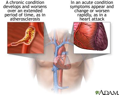 acute  chronic conditions medlineplus medical encyclopedia image