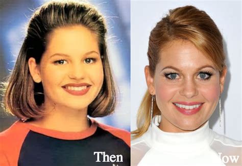 Candace Cameron Plastic Surgery Before And After Photos