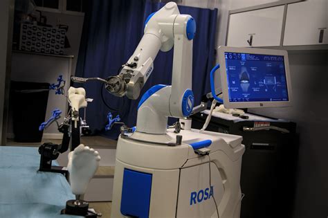 rosa robotic knee surgery trinity health