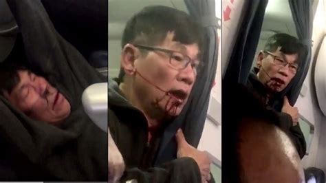 United Airlines Reaches Amicable Settlement With Dragged