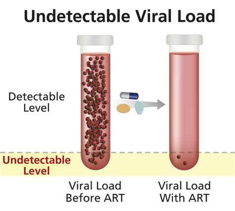 undetectable viral load nih