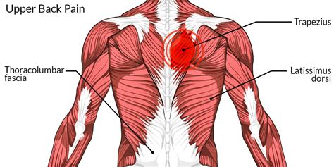 muscles diagram pain