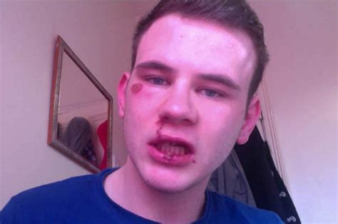 Homphobic Attack Teenager Beaten For Being Gay Daily Star