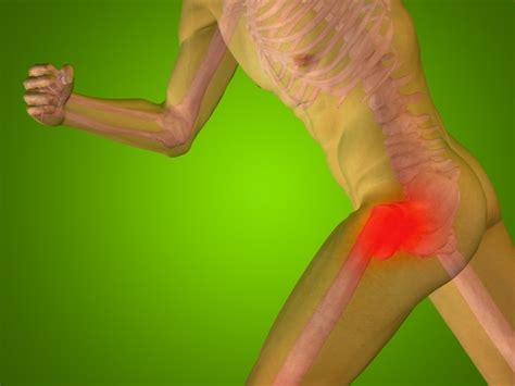 Causes Of Hip Ache Radiating Down Leg Why Hip Flexor Blogs