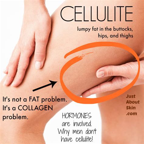 cellulite     treat    skin