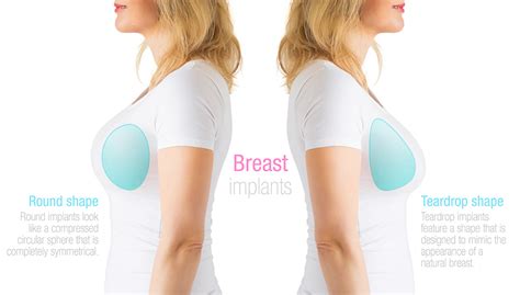 breast implant types northern virginia washington dc  naderi center