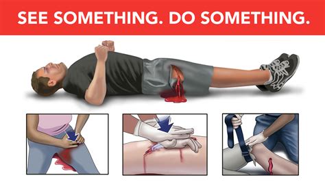 uab news uab surgeons explain stop the bleed initiative and why