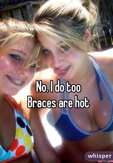 No I Do Too Braces Are Hot