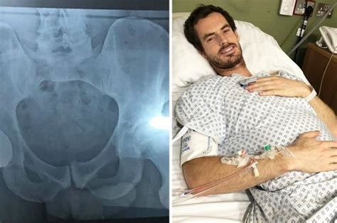 Andy Murray Shares ‘penis’ Snap In Hip Op X Ray Daily Star
