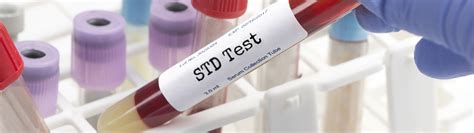 std testing noble county health department