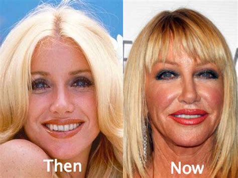 24 worst celebrity plastic surgery before and after pictures top piercings