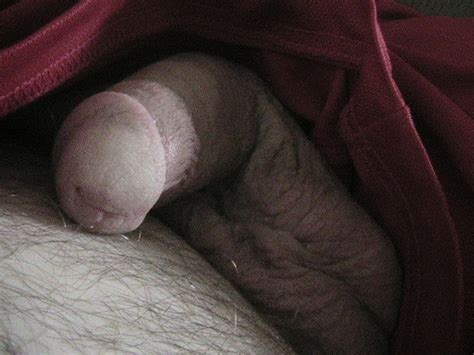 Flaccid Circumcised Penis Pictures 81 Pics Xhamster