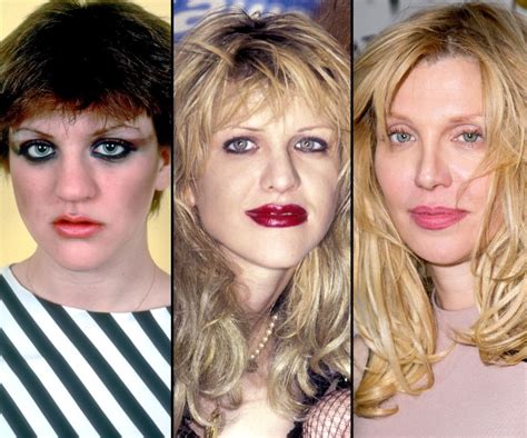 Courtney Love 35 Years Of Plastic Surgery