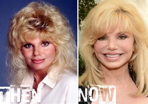 Loni Anderson Plastic Surgery Before And After Hot Sex Picture