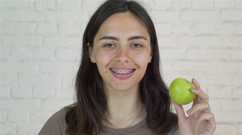 Female With Braces On Her Teeth Eating Green Apple And Smile White