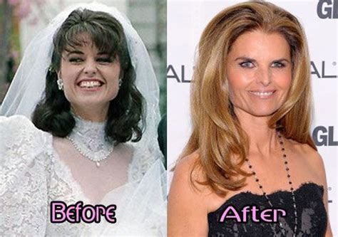 pin by lucia manymore on celebrity before and after pinterest