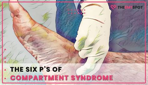 ps  compartment syndrome theemtspot