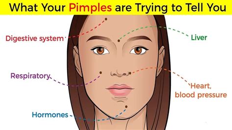 you should know what your pimples are trying to tell you youtube