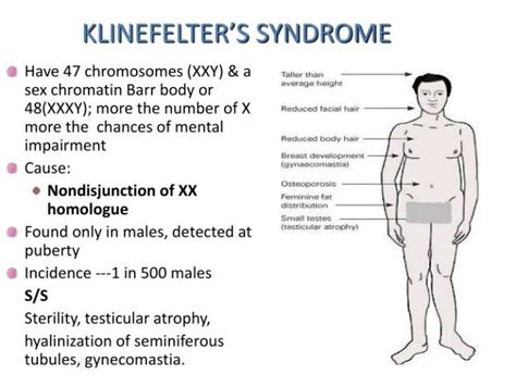 Have You Ever Heard Of Klinefelter Syndrome Girlsaskguys