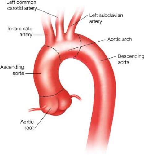 aortic arch anatomy