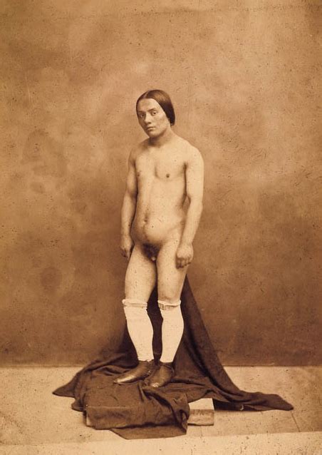 pictures of hermaphrodites and famous examples in history new health advisor