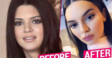 Kendall Jenner Unrecognizable After Plastic Surgery Makeover