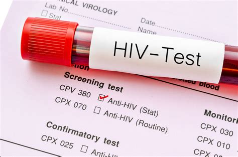 free hiv testing at walgreens on wednesday sun sentinel