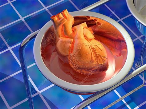 heart surgery artwork stock image  science photo library