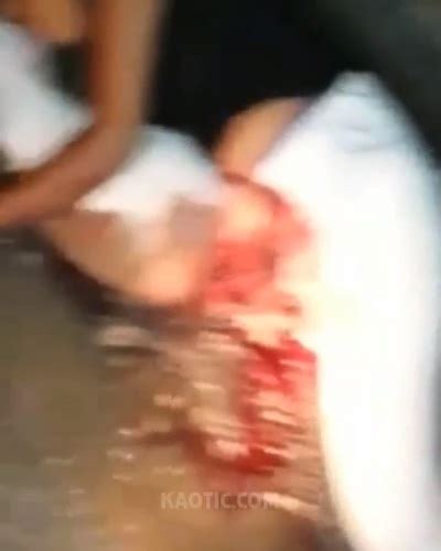 【閲覧注意】事故で女性器から内臓が飛び出てしまった女性が発見される…（動画） ポッカキット