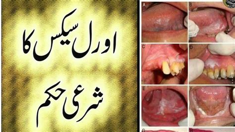 Oral Sex In Islam And Side Effects Urdu And Hindi Home Health Tips