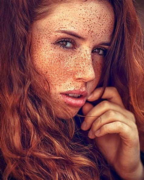 Pin On Freckled
