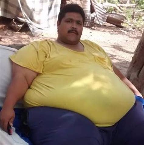 intervenido  exito el hombre mas gordo del mundo llego  pesar  kilos