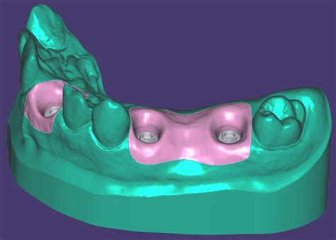 exocad dentalcad smart optics