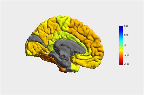 researchers create roadmap  bipolar disorder    affects  brain usc news