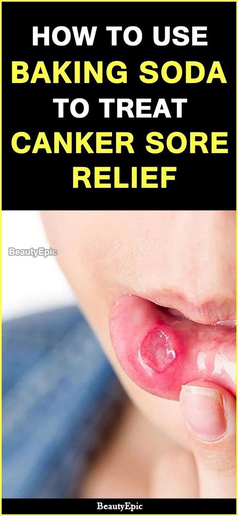how to use baking soda for canker sore relief acneremedies