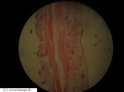 histology   eyelid histololgy