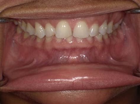 dental patient testimonials  instagram smile design dental spa