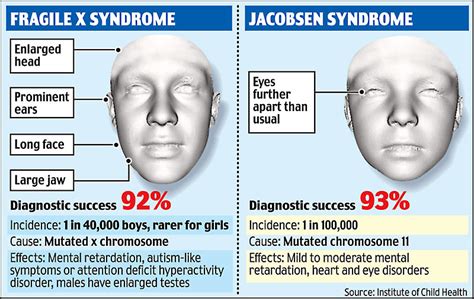 Facial Scans Could Reveal Genetic Disorders Daily Mail Online