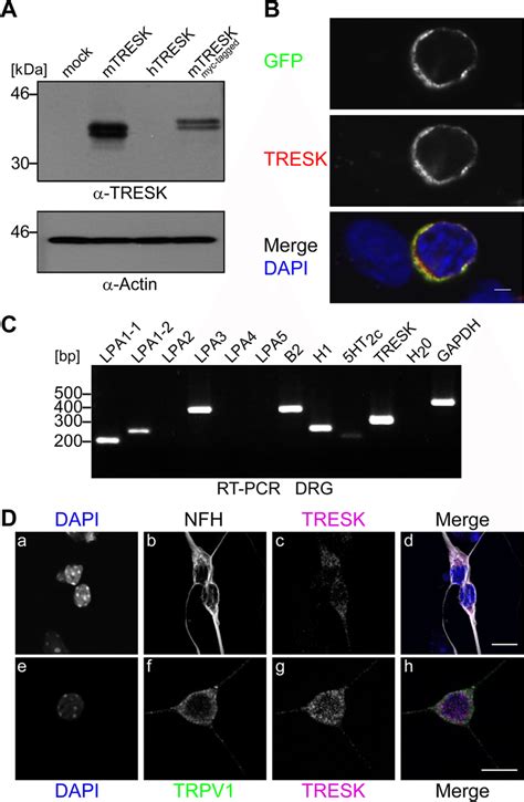 Expression Profile Of Lpa Receptors And Immunodetection Of Tresk