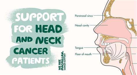 Ask Our Head And Neck Cancer Experts Head And Neck Cancer Group